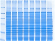Advantages of Protein Gel Documentation Systems