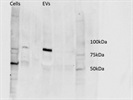 Bands at Different Levels on Western Blot with Calnexin Antibody