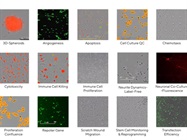 How Live Cell Imaging Benefits Primary Cell Culture