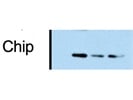 This CHIP Antibody Works Well with Some Background