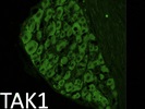 CST TAK1 Antibody Works Well after Optimization
