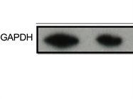 Great Antibody to Detect GAPDH