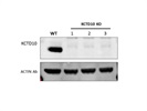 KCTD10 Antibody that Works Well in Western Blot Experiments