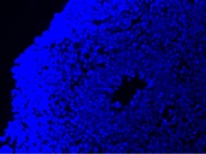 This DAPI Stain Hardens on Its Own, so It's Easy to Use