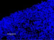 This DAPI Stains Well, but You Must Seal Coverslips