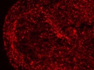 Anti-Nestin Stains Tissue Very Well