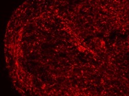 Anti-Nestin Stains Tissue Very Well
