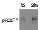 Good Antibody for Phospho-FOXO1 from CST