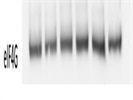Great Antibody for eIF4G from CST