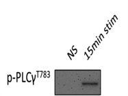 Good Antibody for Phospho-PLCgamma1 from CST