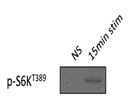Relatively Good Antibody for p-S6K