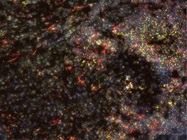 Probing the Tumor Microenvironment