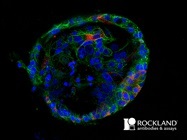 Antibodies for Combatting COVID-19