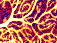 Confocal Microscopy: The End Justifies the Means