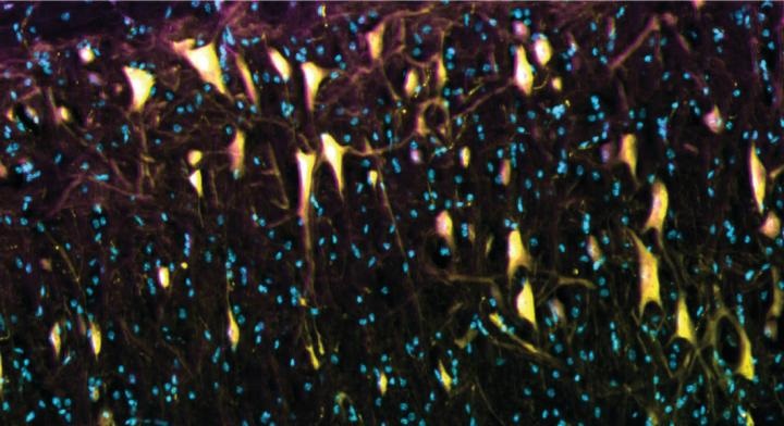 spinal cord