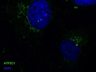 A Good Antibody for ATP2C1 from Proteintech