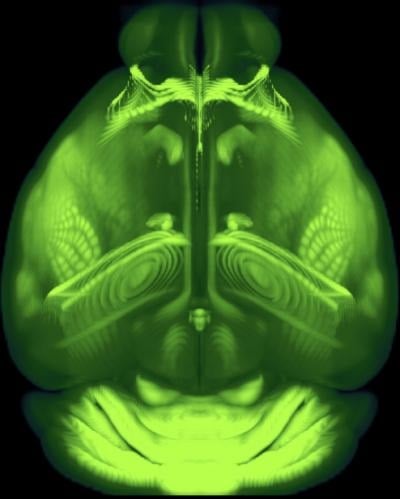 brain