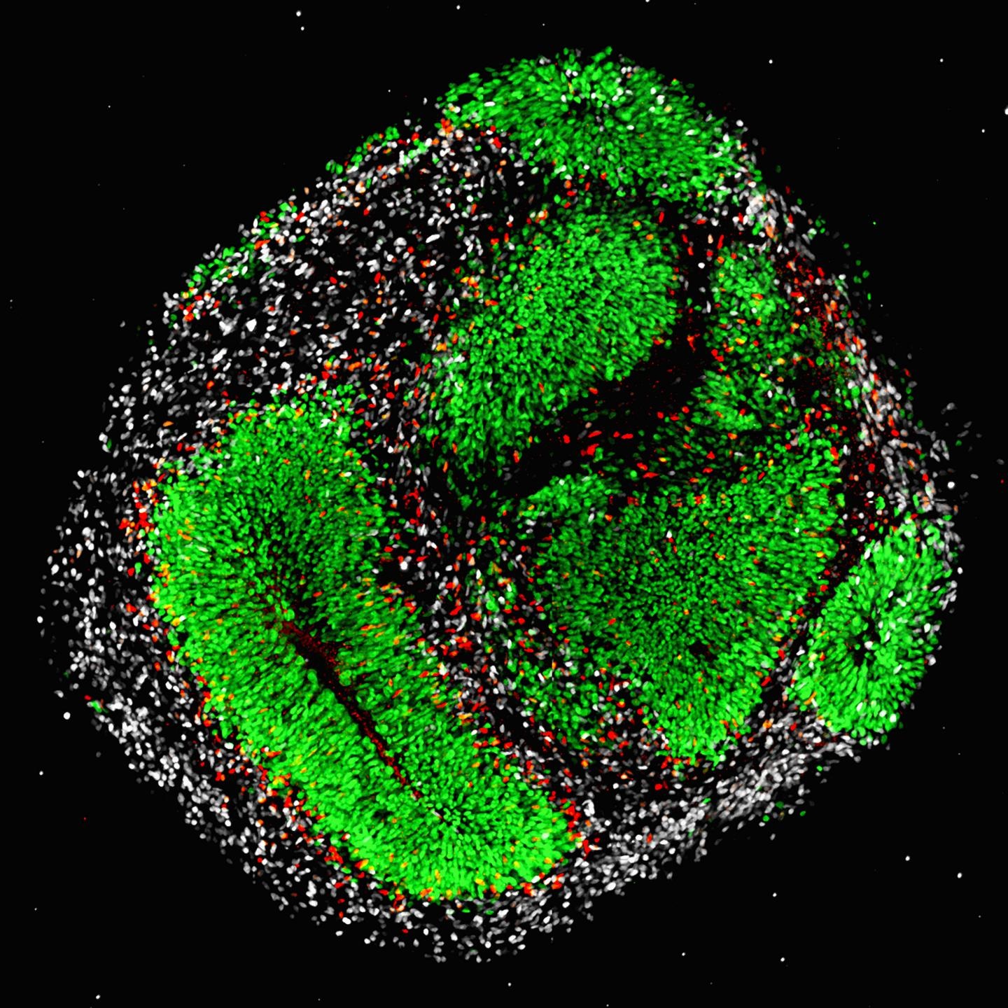 cerebral organoids