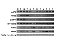 Selecting the Right Western Blotting Detection Method