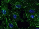 A Good Abcam Antibody for Itga5