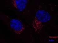 A Good Proteintech Antibody for Gorasp2
