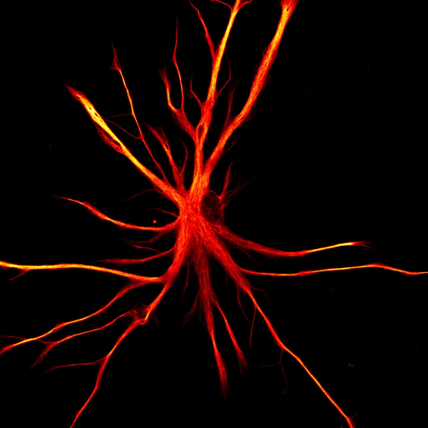 Astrocytes Reactive , An update on reactive astrocytes in chronic pain ...
