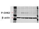 Anti-Phospho-Chk2 Antibody that works great for Immunoblotting