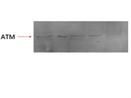Anti-ATM Antibody that Works for Immunoblotting