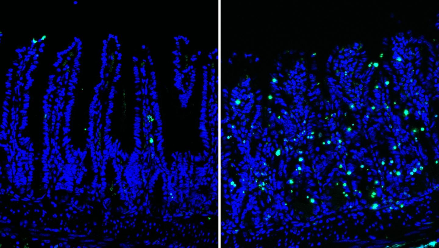 intestinal epithelium