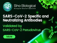 SARS-CoV-2 Specific and Neutralizing Antibodies