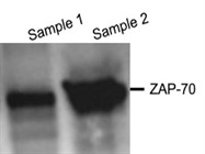 Great Zap-70 Antibody for Western Blotting Using Jurkat Cells