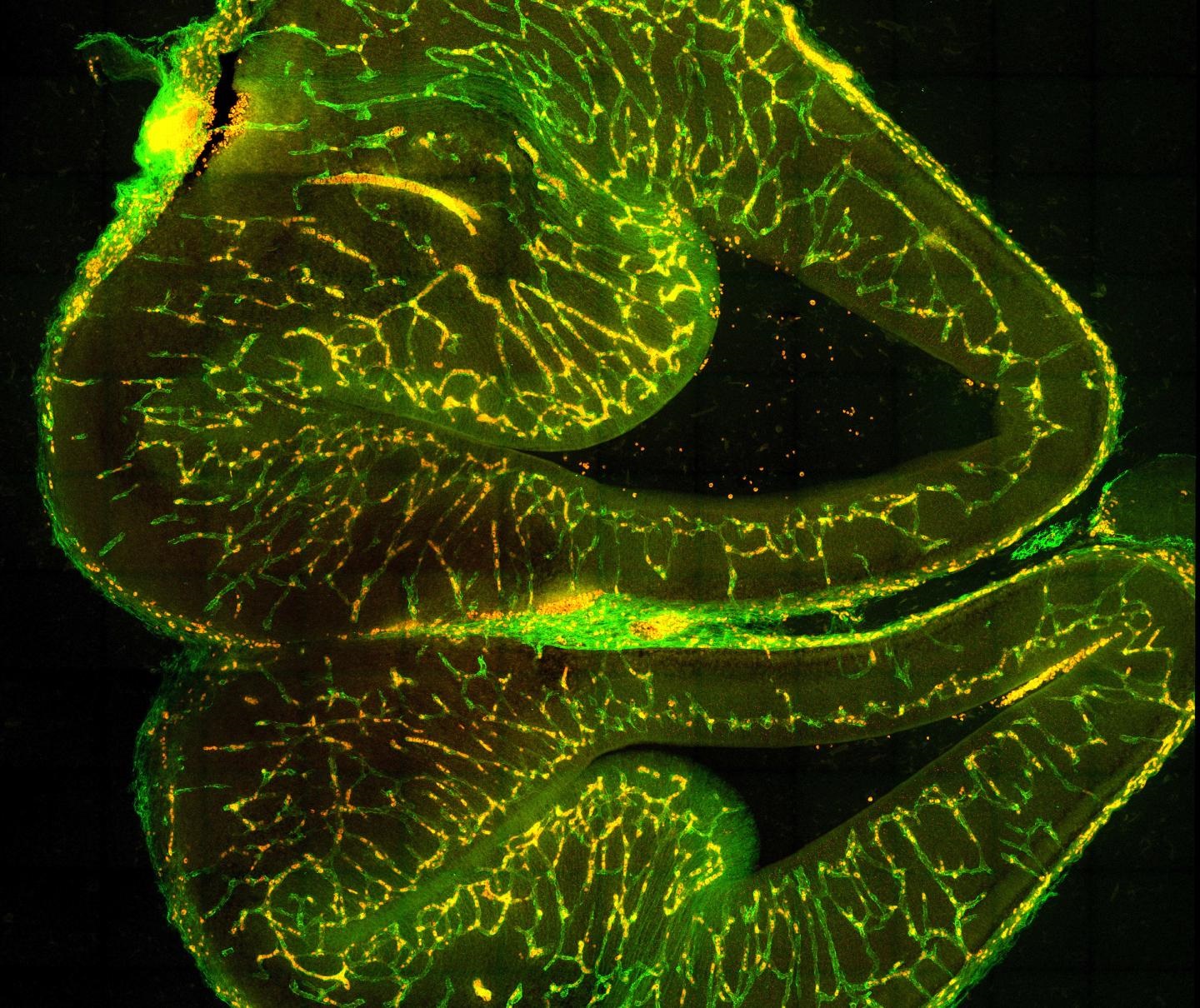 brain blood vessels