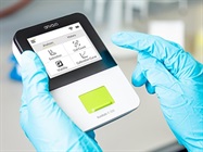 Fluidlab R-300 Give Away: Win the first Portable Cell Counter and Spectrometer!