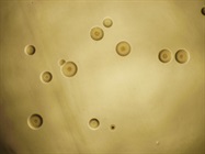Managing Mycoplasma Contamination