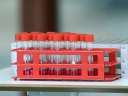 Trends in COVID-19 Testing: Diagnostics and Serological