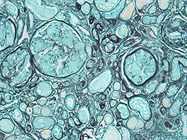A New Look at Light Sheet Microscopy