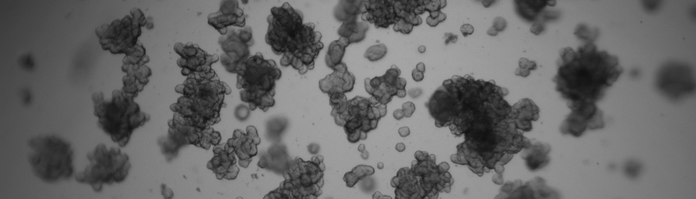  Improving Drug Discovery with Organoids