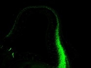 Recommended: NEFM Monoclonal Antibody