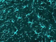 Rabbit Anti-Iba1 Antibody for Immunofluorescence