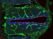 Rabbit Anti-Histone H3-phospho (Ser10) Works Well