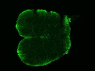 Rabbit Anti-GFAP Has Low Background Staining