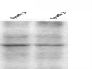 SKP2 Antibody for Western Blot Analysis of Glioma Stem Cell Lysate