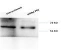 Western Blot Analysis of Glioma Cell Lysate with GAPDH Antibody