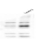 Western Blot Analysis of Glioma Cell Lysate With sox11 Antibody