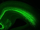 Immunostaining for Axonal Fibers