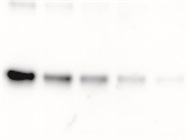 Achieving More Accurate Western Blot Results