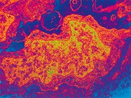 Correlative Microscopy Becoming More Accessible and Fruitful