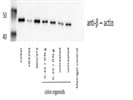 Useful, Well Working Loading Control for Western Blotting