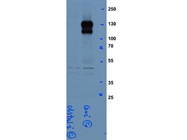 Good Antibody for Clstn1