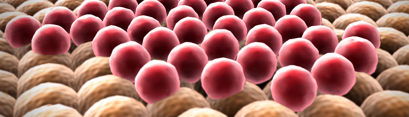  Patient-Derived Organoids Transform Precision Medicine